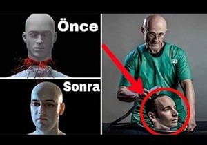 Çin'den 'kafa nakline' izin çıkmadı